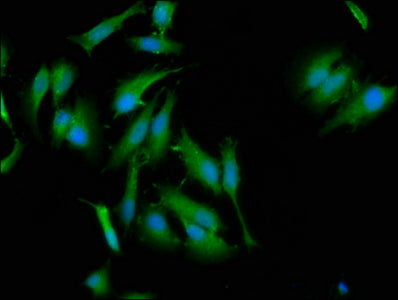 Immunofluorescence staining of Hela cells with NLRC5 Antibody at 1:133, counter-stained with DAPI. The cells were fixed in 4% formaldehyde, permeabilized using 0.2% Triton X-100 and blocked in 10% normal Goat Serum. The cells were then incubated with the antibody overnight at 4°C. The secondary antibody was Alexa Fluor 488-congugated AffiniPure Goat Anti-Rabbit IgG(H+L).Rabbit anti-Human NLRC5 Polyclonal Antibody