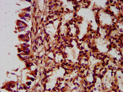IHC image of the antibody diluted at 1:400 and staining in paraffin-embedded human lung tissue performed on a Leica BondTM system. After dewaxing and hydration, antigen retrieval was mediated by high pressure in a citrate buffer (pH 6.0). Section was blocked with 10% normal goat serum 30min at RT. Then primary antibody (1% BSA) was incubated at 4°C overnight. The primary is detected by a biotinylated secondary antibody and visualized using an HRP conjugated SP system.Rabbit anti-Human NLRC5 Polyclonal Antibody
