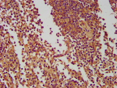 IHC image of NLRC5 Antibody diluted at 1:400 and staining in paraffin-embedded human spleen tissue performed on a Leica BondTM system. After dewaxing and hydration, antigen retrieval was mediated by high pressure in a citrate buffer (pH 6.0). Section was blocked with 10% normal goat serum 30min at RT. Then primary antibody (1% BSA) was incubated at 4°C overnight. The primary is detected by a biotinylated secondary antibody and visualized using an HRP conjugated SP system.Rabbit anti-Human NLRC5 Polyclonal Antibody