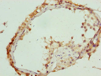 Immunohistochemistry of paraffin-embedded human testis tissue using C17orf64 Antibody at dilution of 1:100