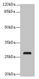 Western blot  | All lanes: C17orf64 antibody at 4µg/ml + Mouse gonadal tissue  | Secondary  | Goat polyclonal to rabbit IgG at 1/10000 dilution  | Predicted band size: 28 kDa  | Observed band size: 28 kDa