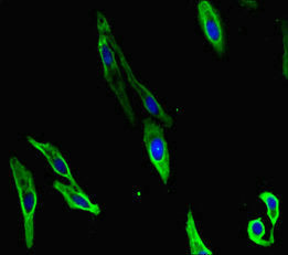 Immunofluorescent analysis of Hela cells using CARM1 Antibody at dilution of 1:100 and Alexa Fluor 488-congugated AffiniPure Goat Anti-Rabbit IgG(H+L)