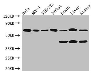 Western Blot | Positive WB detected in: Hela whole cell lysate, MCF-7 whole cell lysate, NIH/3T3 whole cell lysate, Jurkat whole cell lysate, Mouse brain tissue, Mouse liver tissue, Mouse kidney tissue | All lanes: CARM1 antibody at 3.4μg/ml | Secondary | Goat polyclonal to rabbit IgG at 1/50000 dilution | Predicted band size: 66, 64, 42 kDa | Observed band size: 66, 42 kDa