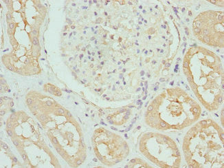 Immunohistochemistry of paraffin-embedded human kidney tissue using DCXR Antibody at dilution of 1:100Rabbit anti-Human DCXR Polyclonal Antibody