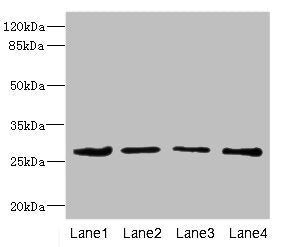 Western blot | All lanes: DCXR antibody at 2.93μg/ml | Lane 1: Mouse gonadal tissue | Lane 2: HepG2 whole cell lysate | Lane 3: A431 whole cell lysate | Lane 4: MCF-7 whole cell lysate | Secondary | Goat polyclonal to rabbit IgG at 1/10000 dilution | Predicted band size: 26 kDa | Observed band size: 26 kDaRabbit anti-Human DCXR Polyclonal Antibody