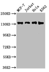 Western Blot  | Positive WB detected in: MCF-7 whole cell lysate, Jurkat whole cell lysate, Hela whole cell lysate, K562 whole cell lysate  | All lanes: WAPL antibody at 2.5µg/ml  | Secondary  | Goat polyclonal to rabbit IgG at 1/50000 dilution  | Predicted band size: 133, 138, 143 kDa  | Observed band size: 133 kDaRabbit anti-Human WAPL Polyclonal Antibody