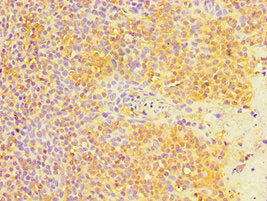 Immunohistochemistry of paraffin-embedded human tonsil tissue using MTDH Antibody at dilution of 1:100Rabbit anti-Human MTDH Polyclonal Antibody