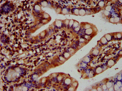IHC image of KTN1 Antibody diluted at 1:400 and staining in paraffin-embedded human small intestine tissue performed on a Leica BondTM system. After dewaxing and hydration, antigen retrieval was mediated by high pressure in a citrate buffer (pH 6.0). Section was blocked with 10% normal goat serum 30min at RT. Then primary antibody (1% BSA) was incubated at 4°C overnight. The primary is detected by a biotinylated secondary antibody and visualized using an HRP conjugated SP system.