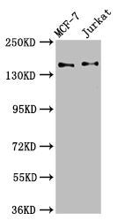Western Blot | Positive WB detected in: MCF-7 whole cell lysate, Jurkat whole cell lysate | All lanes: KTN1 antibody at 3.4μg/ml | Secondary | Goat polyclonal to rabbit IgG at 1/50000 dilution | Predicted band size: 157, 150, 151, 153 kDa | Observed band size: 157 kDa