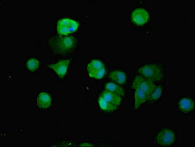 Immunofluorescent analysis of MCF-7 cells using SMG6 Antibody at dilution of 1:100 and Alexa Fluor 488-congugated AffiniPure Goat Anti-Rabbit IgG(H+L)Rabbit anti-Human SMG6 Polyclonal Antibody