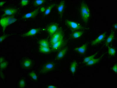 Immunofluorescence staining of Hela cells with NLRP10 Antibody at 1:133, counter-stained with DAPI. The cells were fixed in 4% formaldehyde, permeabilized using 0.2% Triton X-100 and blocked in 10% normal Goat Serum. The cells were then incubated with the antibody overnight at 4°C. The secondary antibody was Alexa Fluor 488-congugated AffiniPure Goat Anti-Rabbit IgG(H+L).Rabbit anti-Human NLRP10 Polyclonal Antibody