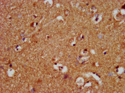 IHC image of NLRP10 Antibody diluted at 1:400 and staining in paraffin-embedded human brain tissue performed on a Leica BondTM system. After dewaxing and hydration, antigen retrieval was mediated by high pressure in a citrate buffer (pH 6.0). Section was blocked with 10% normal goat serum 30min at RT. Then primary antibody (1% BSA) was incubated at 4°C overnight. The primary is detected by a biotinylated secondary antibody and visualized using an HRP conjugated SP system.Rabbit anti-Human NLRP10 Polyclonal Antibody