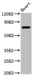 Western Blot | Positive WB detected in: Rat heart tissue | All lanes: NLRP10 antibody at 4.9μg/ml | Secondary | Goat polyclonal to rabbit IgG at 1/50000 dilution | Predicted band size: 76 kDa | Observed band size: 76 kDaRabbit anti-Human NLRP10 Polyclonal Antibody