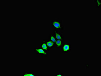 Immunofluorescent analysis of HepG2 cells using SBF2 Antibody at dilution of 1:100 and Alexa Fluor 488-congugated AffiniPure Goat Anti-Rabbit IgG(H+L)Rabbit anti-Human SBF2 Polyclonal Antibody