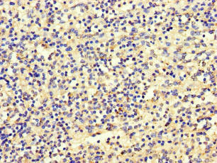 Immunohistochemistry of paraffin-embedded human spleen tissue using the antibody at dilution of 1:100Rabbit anti-Human SBF2 Polyclonal Antibody
