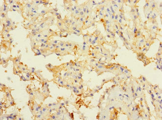 Immunohistochemistry of paraffin-embedded human lung tissue using CIR1 Antibody at dilution of 1:100Rabbit anti-Human CIR1 Polyclonal Antibody