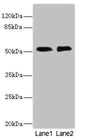 Western blot | All lanes: TMOD1 antibody at 2.84μg/ml | Lane 1: PC-3 whole cell lysate | Lane 2: 293T whole cell lysate | Secondary | Goat polyclonal to rabbit IgG at 1/10000 dilution | Predicted band size: 53, 24 kDa | Observed band size: 53 kDaRabbit anti-Human CIR1 Polyclonal Antibody