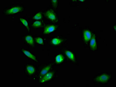 Immunofluorescence staining of Hela cells cells with DDX42 Antibody at 1:200, counter-stained with DAPI. The cells were fixed in 4% formaldehyde, permeabilized using 0.2% Triton X-100 and blocked in 10% normal Goat Serum. The cells were then incubated with the antibody overnight at 4°C. The secondary antibody was Alexa Fluor 488-congugated AffiniPure Goat Anti-Rabbit IgG(H+L).Rabbit anti-Human DDX42 Polyclonal Antibody