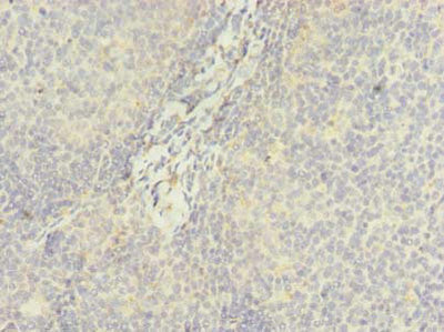 Immunohistochemistry of paraffin-embedded human tonsil tissue using the antibody at dilution of 1:100Rabbit anti-Human DDX42 Polyclonal Antibody