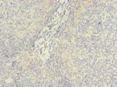 Immunohistochemistry of paraffin-embedded human tonsil tissue using the antibody at dilution of 1:100Rabbit anti-Human DDX42 Polyclonal Antibody