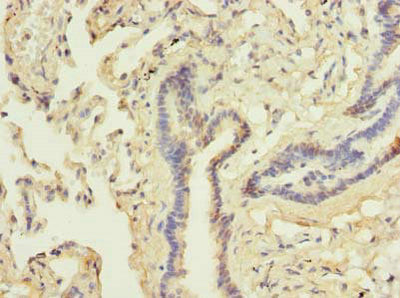 Immunohistochemistry of paraffin-embedded human lung tissue using DDX42 Antibody at dilution of 1:100Rabbit anti-Human DDX42 Polyclonal Antibody