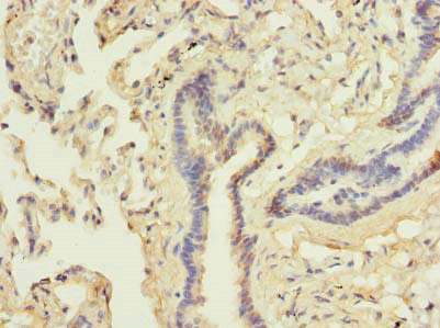 Immunohistochemistry of paraffin-embedded human lung tissue using DDX42 Antibody at dilution of 1:100Rabbit anti-Human DDX42 Polyclonal Antibody