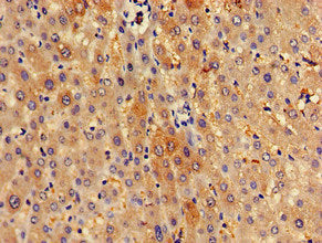 Immunohistochemistry of paraffin-embedded human liver tissue using SPRED1 Antibody at dilution of 1:100