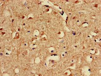 Immunohistochemistry of paraffin-embedded human brain tissue using SPRED1 Antibody at dilution of 1:100