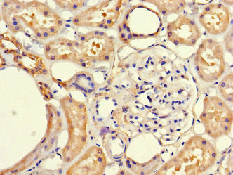 Immunohistochemistry of paraffin-embedded human kidney tissue using FRMD5 Antibody at dilution of 1:100Rabbit anti-Human FRMD5 Polyclonal Antibody