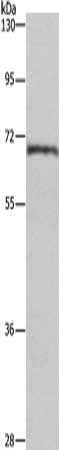 Gel: 6%SDS-PAGE, Lysate: 40 μg, Lane: Human normal liver tissue, Primary antibody: CDK5RAP3 Antibody(CDK5RAP3 Antibody) at dilution 1/655, Secondary antibody: Goat anti rabbit IgG at 1/8000 dilution, Exposure time: 1 secondRabbit anti-Human CDK5RAP3 Polyclonal Antibody