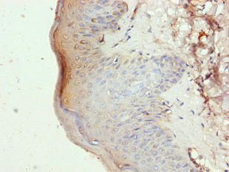 Immunohistochemistry of paraffin-embedded human skin tissue using SLC46A3 Antibody at dilution of 1:100Rabbit anti-Human SLC46A3 Polyclonal Antibody