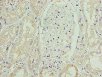 Immunohistochemistry of paraffin-embedded human kidney tissue using SLC46A3 Antibody at dilution of 1:100Rabbit anti-Human SLC46A3 Polyclonal Antibody