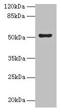 Western blot  | All lanes: SLC46A3 antibody at 4µg/ml + Jurkat whole cell lysate  | Secondary  | Goat polyclonal to rabbit IgG at 1/10000 dilution  | Predicted band size: 52, 43 kDa  | Observed band size: 52 kDaRabbit anti-Human SLC46A3 Polyclonal Antibody