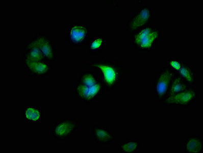 Immunofluorescence staining of MCF-7 cells with MYH14 Antibody at 1:100, counter-stained with DAPI. The cells were fixed in 4% formaldehyde, permeabilized using 0.2% Triton X-100 and blocked in 10% normal Goat Serum. The cells were then incubated with the antibody overnight at 4°C. The secondary antibody was Alexa Fluor 488-congugated AffiniPure Goat Anti-Rabbit IgG(H+L).Rabbit anti-Human MYH14 Polyclonal Antibody