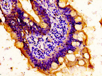 IHC image of MYH14 Antibody diluted at 1:100 and staining in paraffin-embedded human small intestine tissue performed on a Leica BondTM system. After dewaxing and hydration, antigen retrieval was mediated by high pressure in a citrate buffer (pH 6.0). Section was blocked with 10% normal goat serum 30min at RT. Then primary antibody (1% BSA) was incubated at 4°C overnight. The primary is detected by a biotinylated secondary antibody and visualized using an HRP conjugated ABC system.Rabbit anti-Human MYH14 Polyclonal Antibody