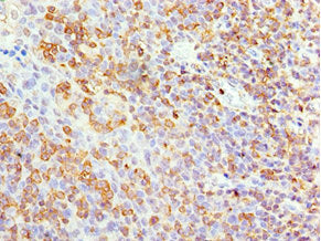Immunohistochemistry of paraffin-embedded human tonsil tissue using APBB1IP Antibody at dilution of 1:100Rabbit anti-Human APBB1IP Polyclonal Antibody