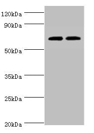 Western blot | All lanes: APBB1IP antibody at 4μg/ml | Lane 1: HL60 whole cell lysate | Lane 2: Rat spleen tissue | Secondary | Goat polyclonal to rabbit IgG at 1/10000 dilution | Predicted band size: 74, 19 kDa | Observed band size: 74 kDaRabbit anti-Human APBB1IP Polyclonal Antibody