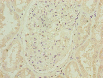 Immunohistochemistry of paraffin-embedded human kidney tissue using ARPIN Antibody at dilution of 1:100Rabbit anti-Human ARPIN Polyclonal Antibody