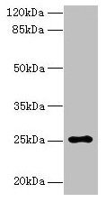 Western blot  | All lanes: ARPIN antibody at 0.5µg/ml + HepG2 whole cell lysate  | Secondary  | Goat polyclonal to rabbit IgG at 1/10000 dilution  | Predicted band size: 25, 44 kDa  | Observed band size: 25 kDa