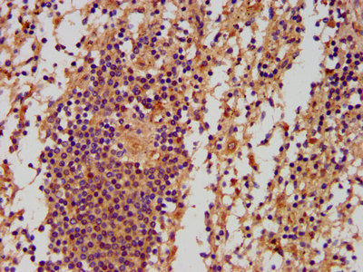 IHC image of PNPLA5 Antibody diluted at 1:500 and staining in paraffin-embedded human spleen tissue performed on a Leica BondTM system. After dewaxing and hydration, antigen retrieval was mediated by high pressure in a citrate buffer (pH 6.0). Section was blocked with 10% normal goat serum 30min at RT. Then primary antibody (1% BSA) was incubated at 4°C overnight. The primary is detected by a biotinylated secondary antibody and visualized using an HRP conjugated SP system.Rabbit anti-Human PNPLA5 Polyclonal Antibody