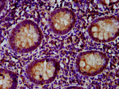 IHC image of PNPLA5 Antibody diluted at 1:500 and staining in paraffin-embedded human appendix tissue performed on a Leica BondTM system. After dewaxing and hydration, antigen retrieval was mediated by high pressure in a citrate buffer (pH 6.0). Section was blocked with 10% normal goat serum 30min at RT. Then primary antibody (1% BSA) was incubated at 4°C overnight. The primary is detected by a biotinylated secondary antibody and visualized using an HRP conjugated SP system.Rabbit anti-Human PNPLA5 Polyclonal Antibody