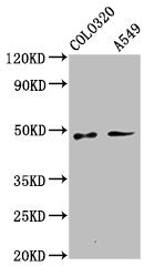 Western Blot  | Positive WB detected in: Colo320 whole cell lysate, A549 whole cell lysate  | All lanes: PNPLA5 antibody at 3.1µg/ml  | Secondary  | Goat polyclonal to rabbit IgG at 1/50000 dilution  | Predicted band size: 48, 36 kDa  | Observed band size: 48 kDaRabbit anti-Human PNPLA5 Polyclonal Antibody