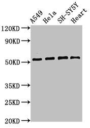 Western Blot  | Positive WB detected in: A549 whole cell lysate, Hela whole cell lysate, SH-SY5Y whole cell lysate, Mouse heart tissue  | All lanes: ATG4D antibody at 2.8µg/ml  | Secondary  | Goat polyclonal to rabbit IgG at 1/50000 dilution  | Predicted band size: 53, 17 kDa  | Observed band size: 53 kDa