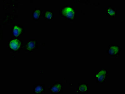 Immunofluorescence staining of MCF-7 cells with RTN4RL2 Antibody at 1:50, counter-stained with DAPI. The cells were fixed in 4% formaldehyde, permeabilized using 0.2% Triton X-100 and blocked in 10% normal Goat Serum. The cells were then incubated with the antibody overnight at 4°C. The secondary antibody was Alexa Fluor 488-congugated AffiniPure Goat Anti-Rabbit IgG(H+L).Rabbit anti-Human RTN4RL2 Polyclonal Antibody