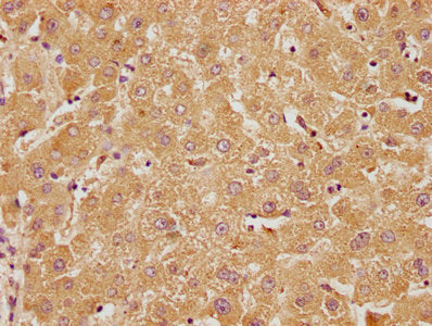 IHC image of RTN4RL2 Antibody diluted at 1:100 and staining in paraffin-embedded human liver tissue performed on a Leica BondTM system. After dewaxing and hydration, antigen retrieval was mediated by high pressure in a citrate buffer (pH 6.0). Section was blocked with 10% normal goat serum 30min at RT. Then primary antibody (1% BSA) was incubated at 4°C overnight. The primary is detected by a biotinylated secondary antibody and visualized using an HRP conjugated SP system.Rabbit anti-Human RTN4RL2 Polyclonal Antibody