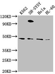 Western Blot | Positive WB detected in: K562 whole cell lysate, SH-SY5Y whole cell lysate, Hela whole cell lysate, HL-60 whole cell lysate | All lanes: RTN4RL2 antibody at 1:2000 | Secondary | Goat polyclonal to rabbit IgG at 1/50000 dilution | Predicted band size: 47, 22 kDa | Observed band size: 47 kDaRabbit anti-Human RTN4RL2 Polyclonal Antibody