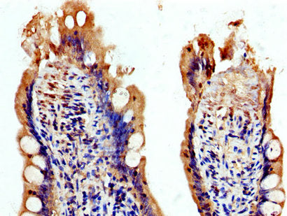 IHC image of USP48 Antibody diluted at 1:200 and staining in paraffin-embedded human small intestine tissue performed on a Leica BondTM system. After dewaxing and hydration, antigen retrieval was mediated by high pressure in a citrate buffer (pH 6.0). Section was blocked with 10% normal goat serum 30min at RT. Then primary antibody (1% BSA) was incubated at 4°C overnight. The primary is detected by a biotinylated secondary antibody and visualized using an HRP conjugated SP system.
