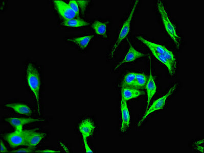 Immunofluorescent analysis of Hela cells using KBTBD6 Antibody at dilution of 1:100 and Alexa Fluor 488-congugated AffiniPure Goat Anti-Rabbit IgG(H+L)