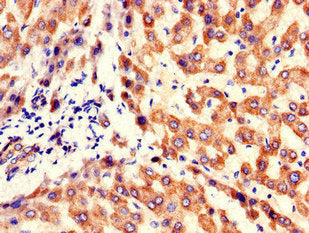 Immunohistochemistry of paraffin-embedded human liver tissue using KBTBD6 Antibody at dilution of 1:100