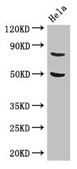 Western Blot  | Positive WB detected in: Hela whole cell lysate  | All lanes: KBTBD6 antibody at 3.4µg/ml  | Secondary  | Goat polyclonal to rabbit IgG at 1/50000 dilution  | Predicted band size: 77 kDa  | Observed band size: 77 kDa
